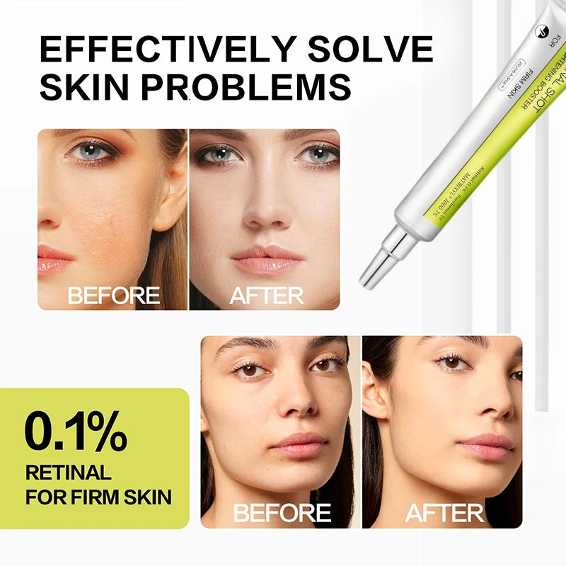 Crème Contour des Yeux Coréenne Rétinol – Anti-Rides, Cernes, Poches & Hydratation Intense