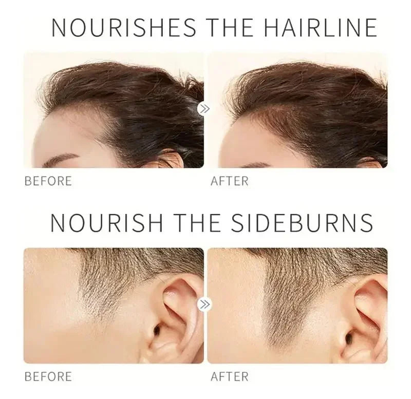 Wimpern- & Brauenwachstumsserum – Schnelleres Wachstum, Dichte & Anti-Haarausfall | Natürliche Pflege für einen intensiven Blick