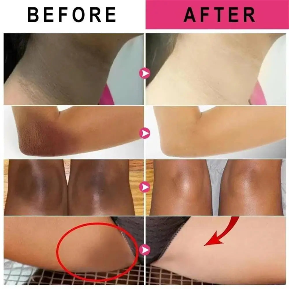 Crème Blanchissante Aisselles & Zone Intime – Hydratante Eclaircissante Coréenne Femme
