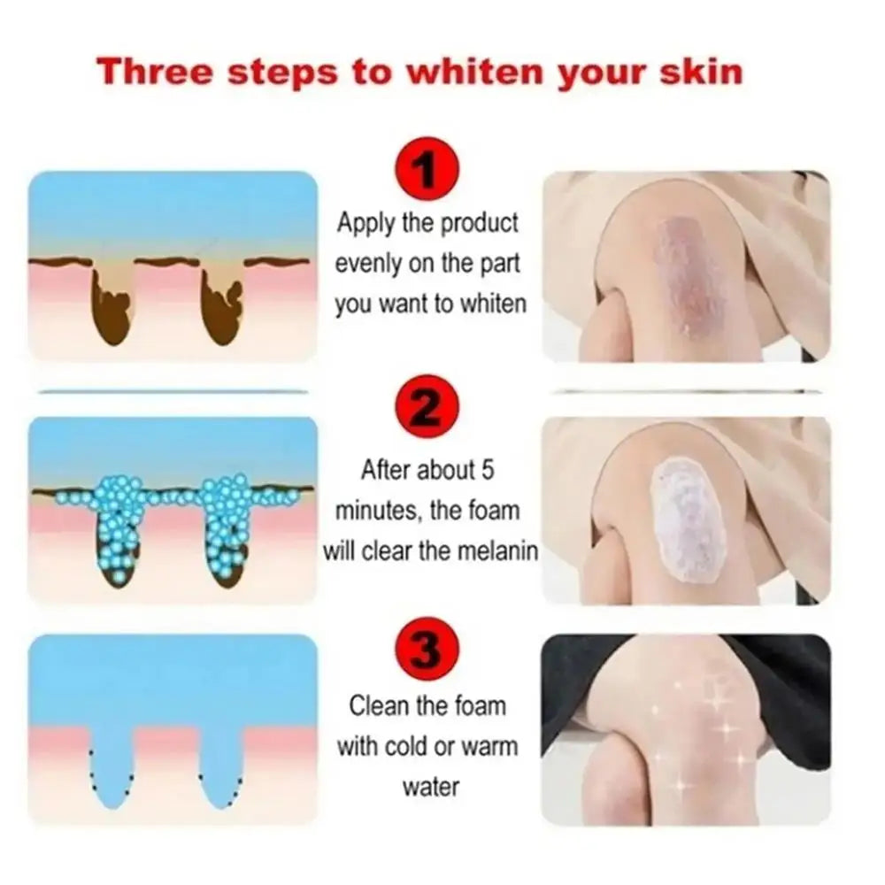 Crème Blanchissante Aisselles & Zone Intime – Hydratante Eclaircissante Coréenne Femme