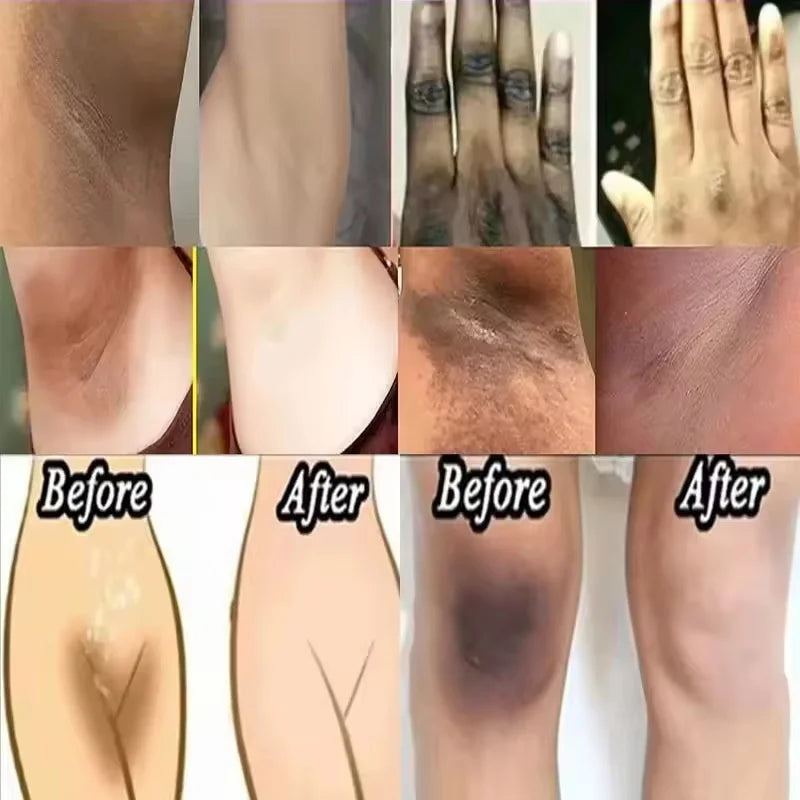 Crème Blanchissante Aisselles & Zone Intime – Hydratante Eclaircissante Coréenne Femme