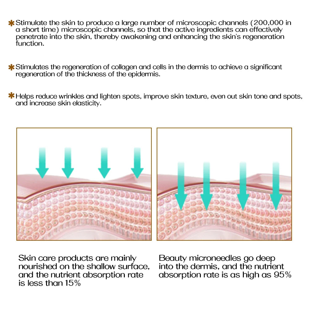 Derma Roller Professionnel 540 Aiguilles – Croissance Cheveux & Barbe, Soin Visage & Corps | 0.2mm 0.25mm 0.3mm