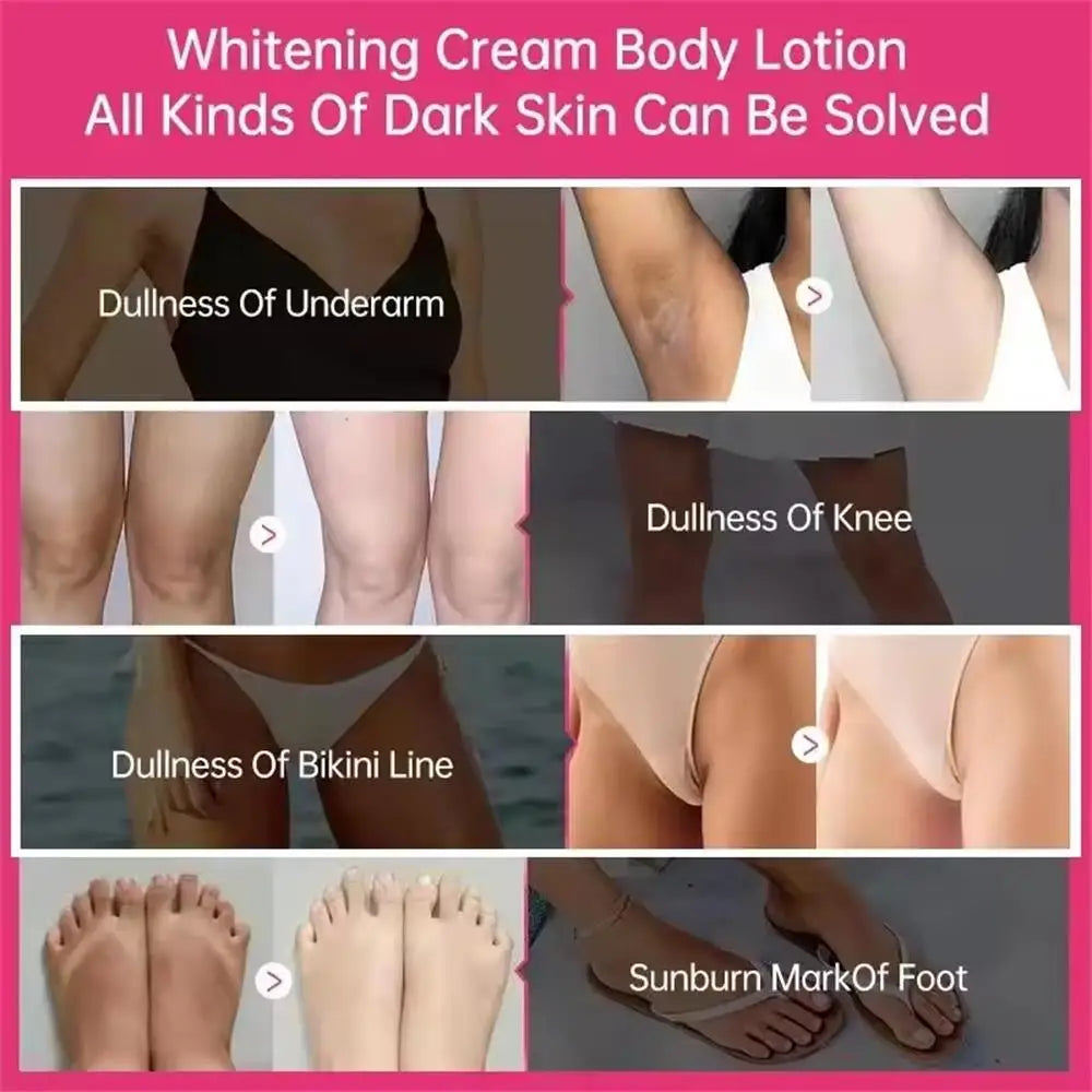 Crème Blanchissante Aisselles & Zone Intime – Hydratante Eclaircissante Coréenne Femme