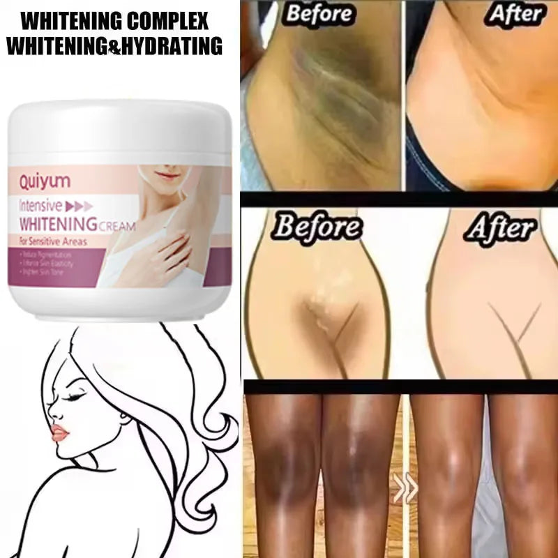 Crème Blanchissante Aisselles & Zone Intime – Hydratante Eclaircissante Coréenne Femme