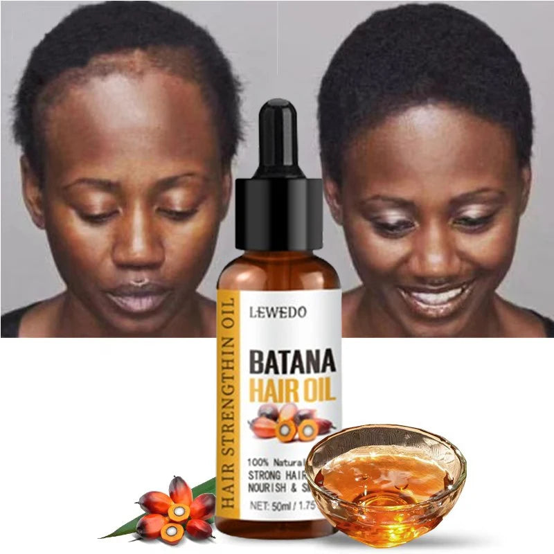 Huile de Batana Pure Lewedo Naturals – Repousse Rapide, Anti-Chute & Brillance | Soin Capillaire Naturel | Homme & Femme