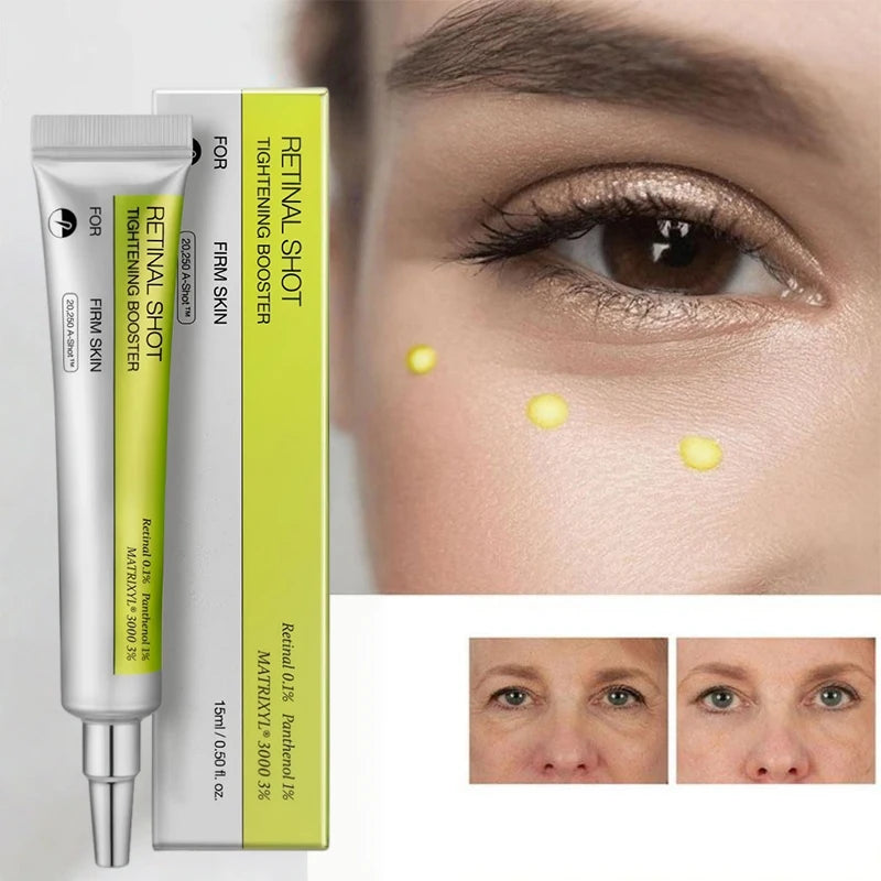 Crème Contour des Yeux Coréenne Rétinol – Anti-Rides, Cernes, Poches & Hydratation Intense