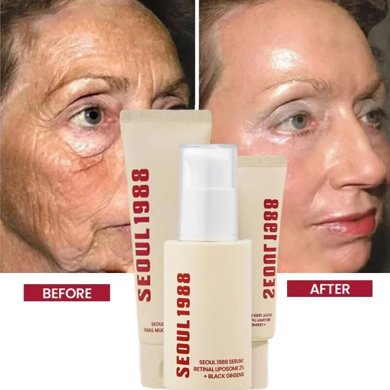 Sérum Visage Rétinol Ginseng Noir Niacinamide 2% – Hydratant Raffermissant Anti-Rides Anti-Âge