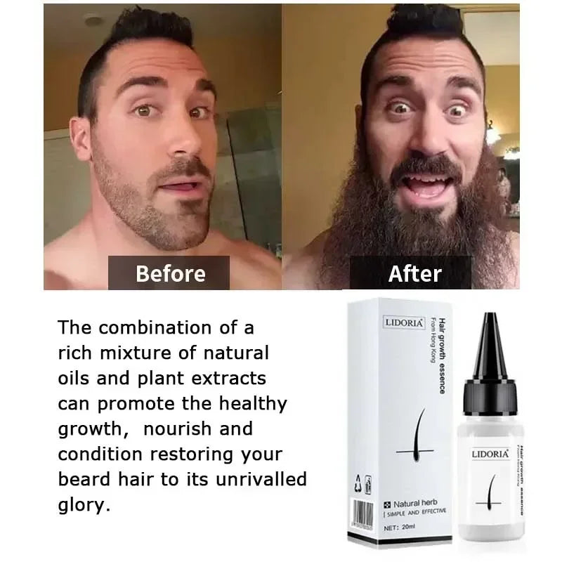 Sérum Croissance Barbe & Poils - Repousse Rapide, Densité & Anti-Alopecie