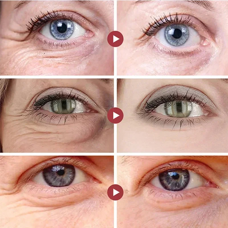 Masque Yeux Collagène Anti-Rides – Patches Hydratants Anti-Cernes Anti-Gonflement Eclat